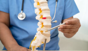 tumor columna y médula espinal