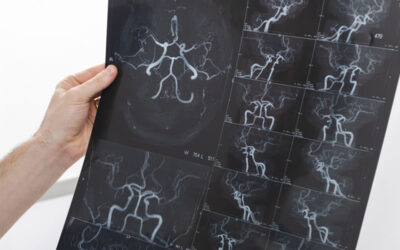 Patología vascular